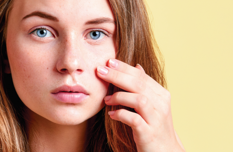 Les astuces naturelles pour lutter contre l’acné
